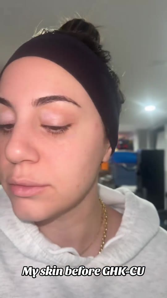 Peptide therapy on TikTok: separating hype from human data