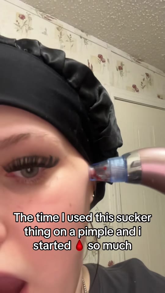 BPC-157 blood injection claims on TikTok: what's real?