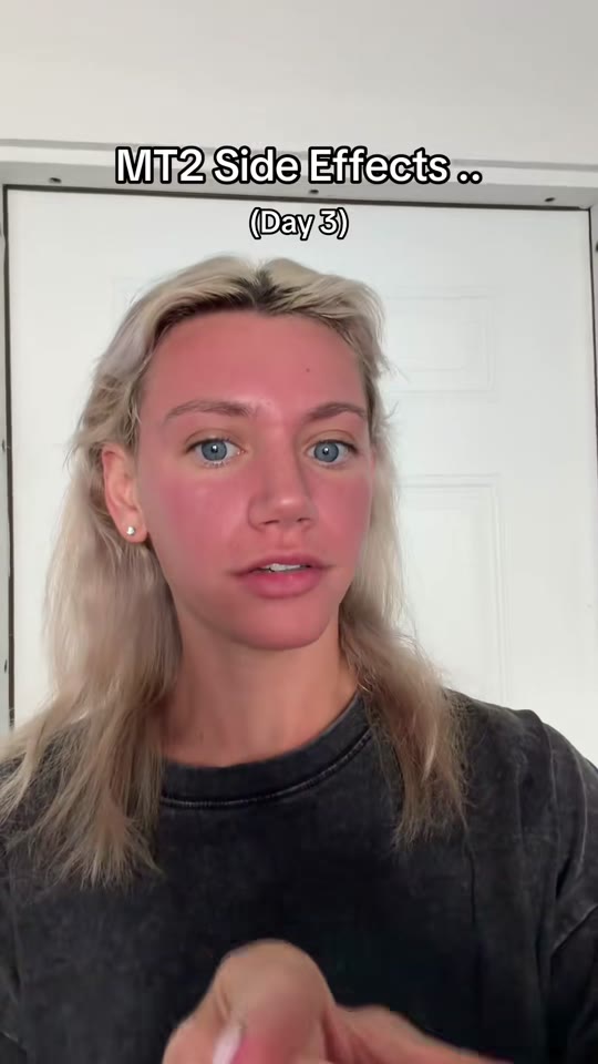 @kianajardot's MT2 peptide update, fact-checked