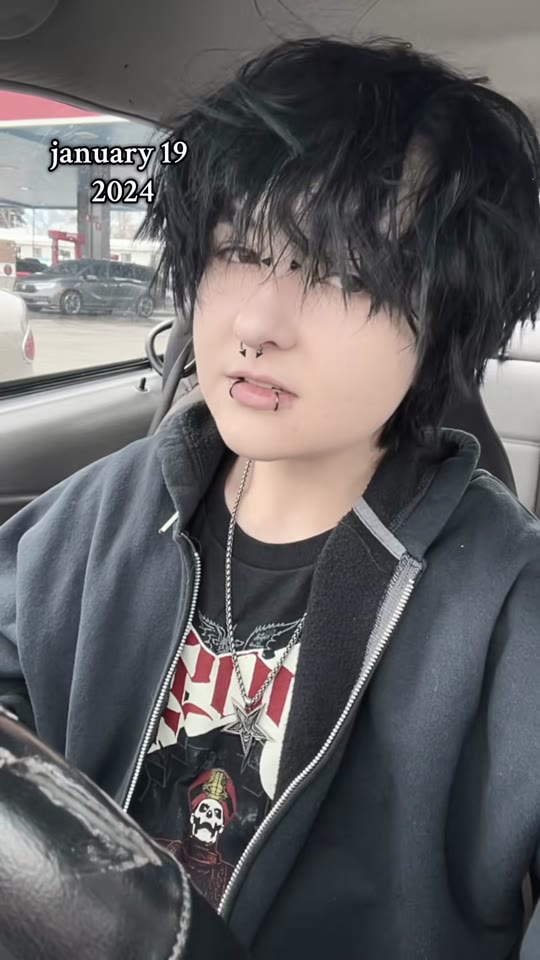 One year on testosterone: what FTM timelines actually show