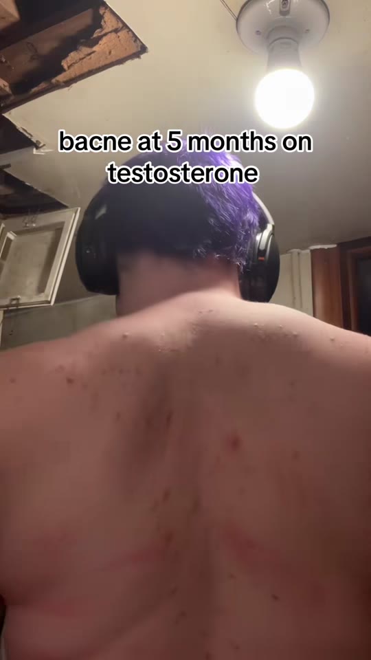 @b3ar_b0n3z's restlessness on testosterone, fact-checked