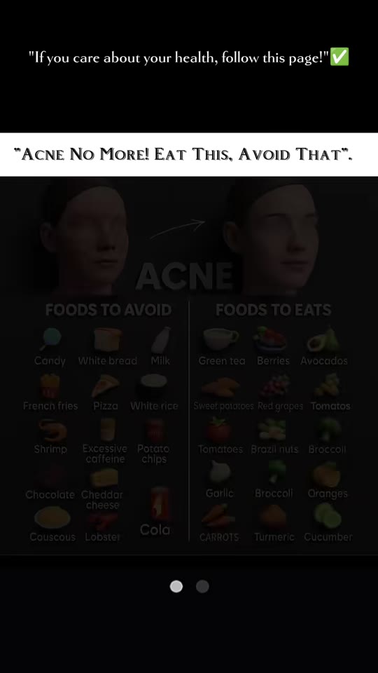 @everyday_wellness98's acne diet claims, fact-checked