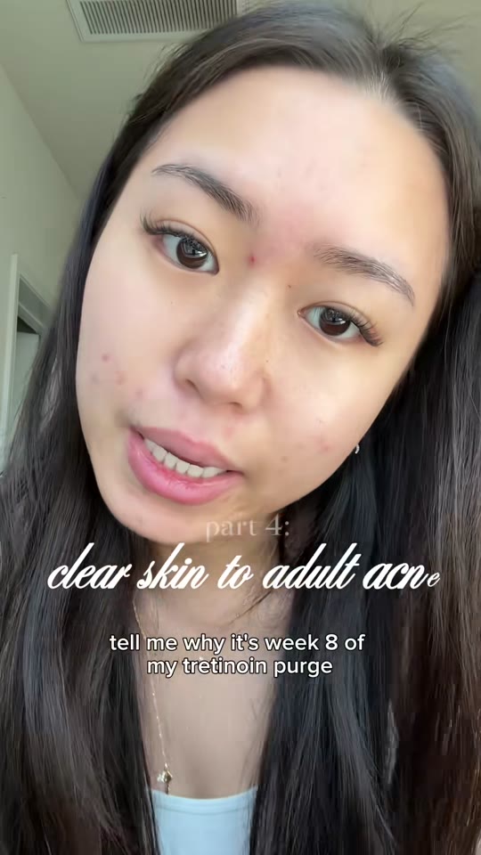@kkateli's tretinoin purge claims, fact-checked