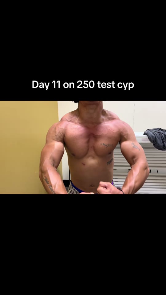@gust2weakbrah's TRT cycle claims need context