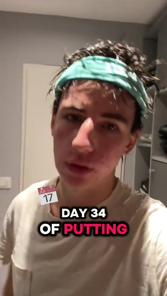 Tretinoin for acne: what 34 days of daily use actually does