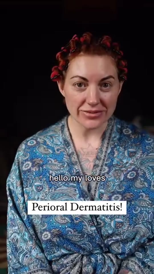 Perioral dermatitis claims from @midlifeinvintage, checked