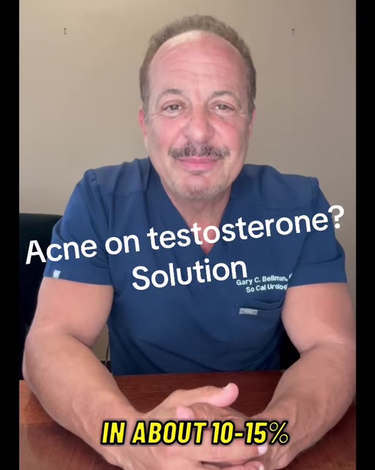 Does testosterone replacement therapy cause acne? We checked