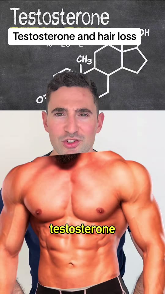 Does testosterone cause hair loss? @trichogenics weighs in
