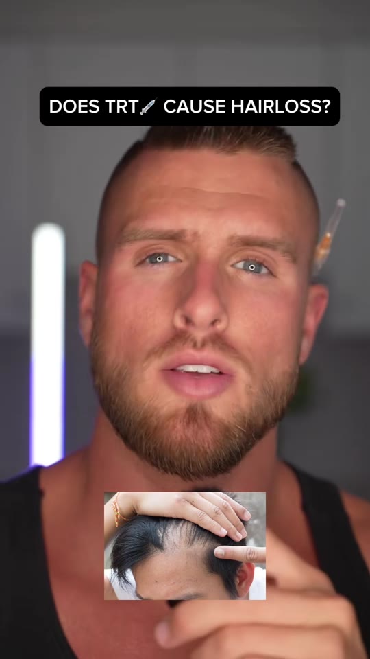 Does TRT actually cause hair loss? Here's what the data shows