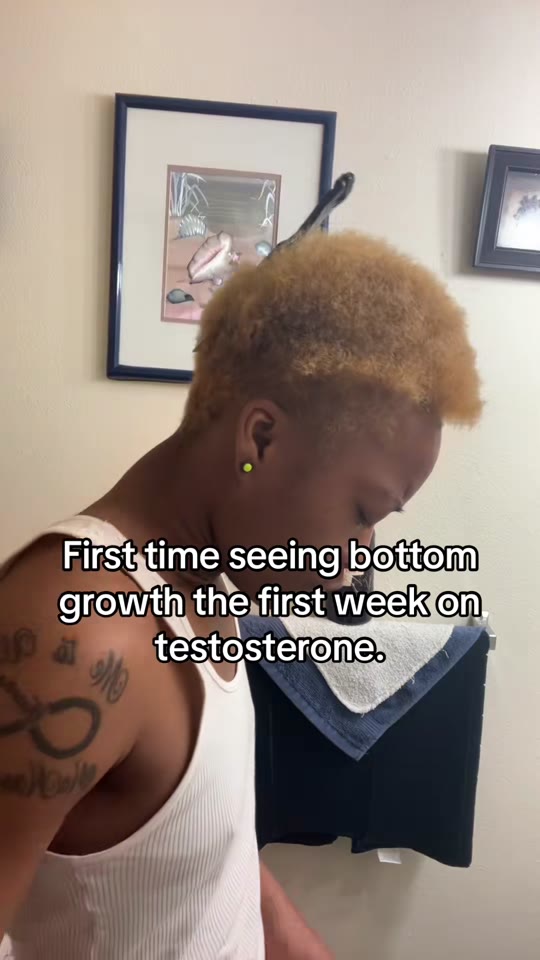 Clitoromegaly from testosterone: how fast does it actually happen?