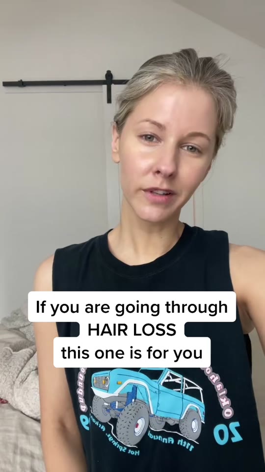 @thevioletfog's prolactinoma hair loss claims, fact-checked