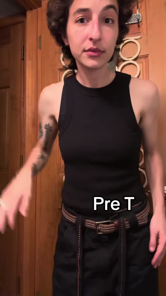Low-dose testosterone for gender-affirming care: what three months actually does