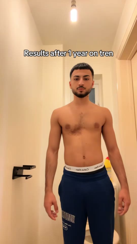 TRT and gym transformations: separating real gains from hype