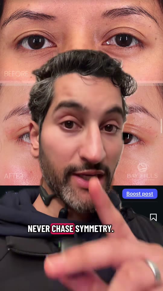 Dr. Tripathi's blepharoplasty symmetry claims, fact-checked