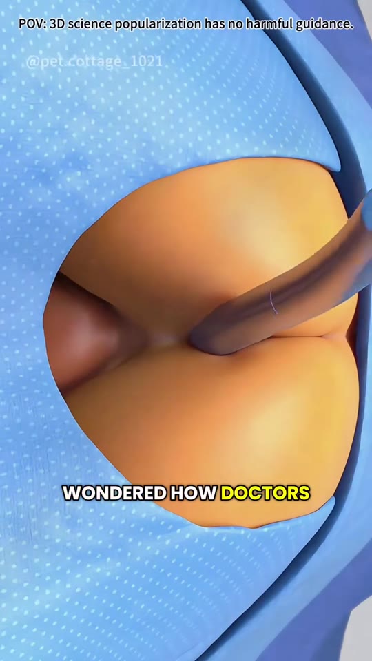 Enema therapy claims on TikTok: what the science actually says