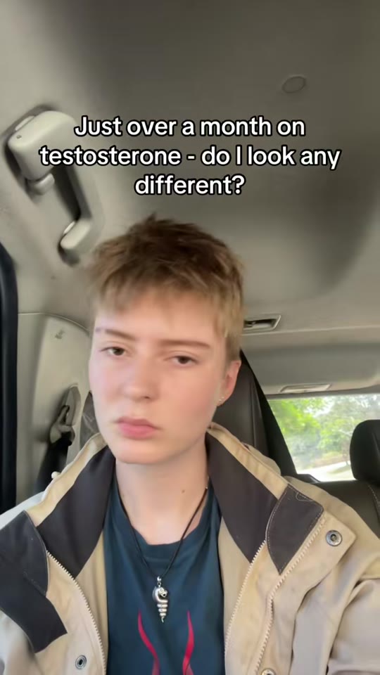 One month on testosterone: what changes are realistic?