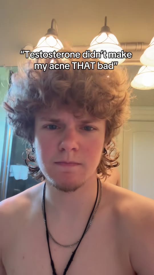 @tjz2025's testosterone acne experience, fact-checked