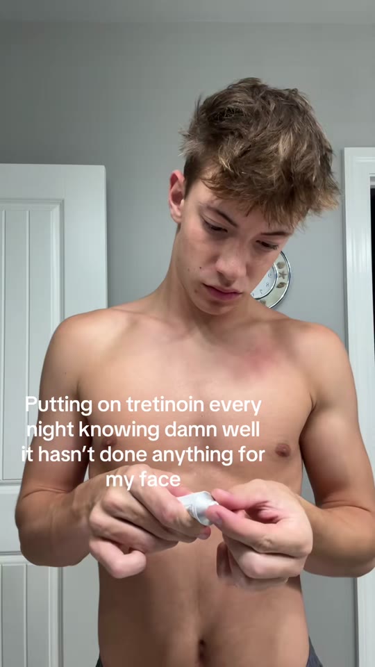 @jswizzspamsss's tretinoin acne claims, fact-checked