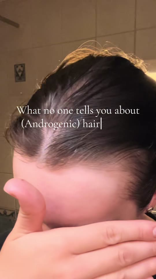 @lillyeve000's insulin resistance hair loss claims checked