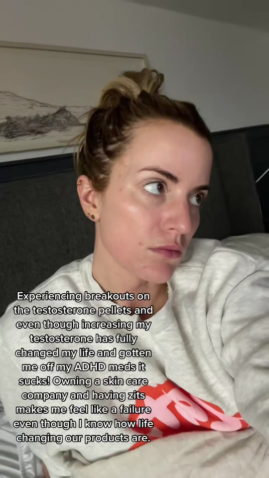@jennas_kitchen's testosterone and acne connection, fact-checked