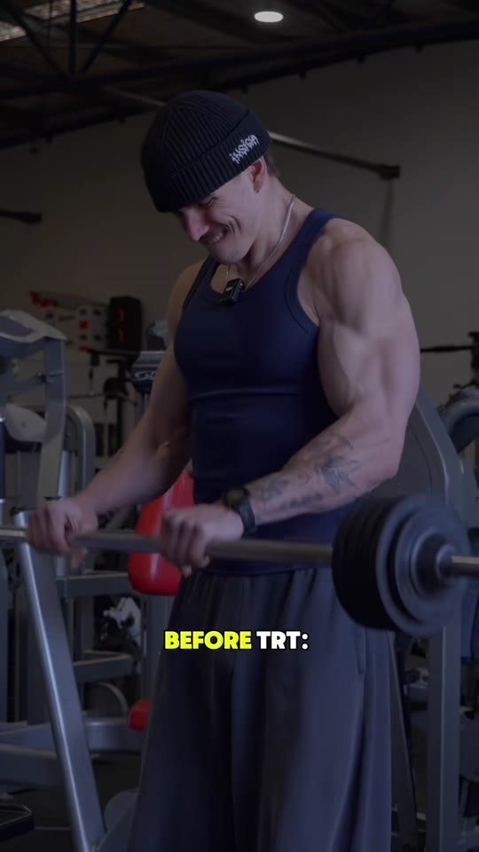 @tonino.luketic's TRT size claims need context