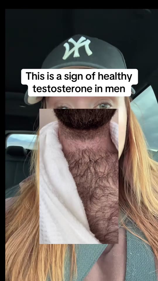 TRT and hair loss claims on TikTok: what the evidence says