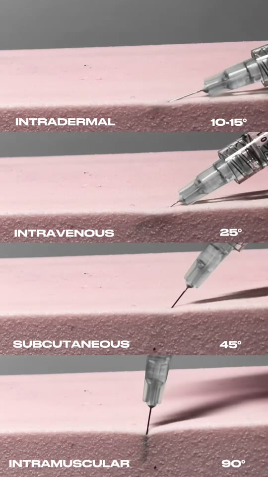 Do injection angles really control TRT placement and safety?