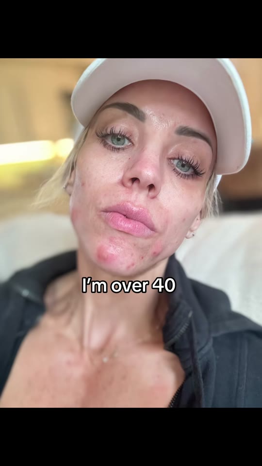 This TikTok skincare routine has nothing to do with TRT