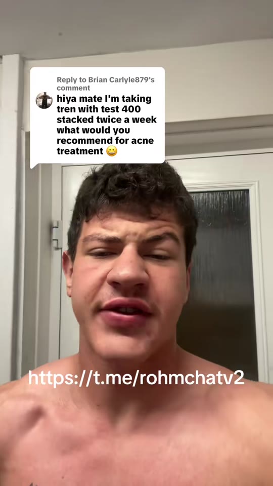 @calxshreds's TRT acne advice gets most things right