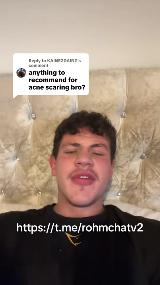 TRT and acne: separating the hype from the hormone science