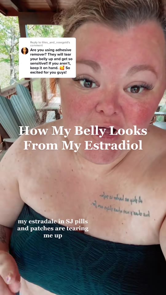 IVF estrogen patches: What the TikTok hype gets right and wrong