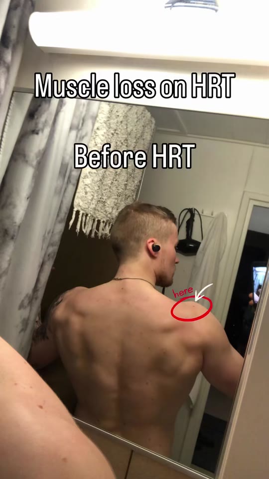 MTF HRT on TikTok: separating hope from hype