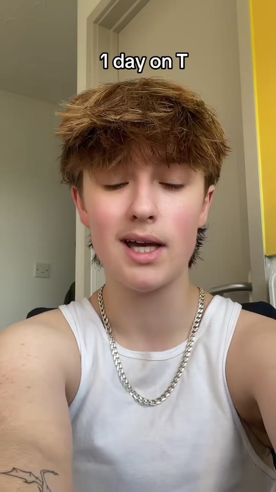 FTM testosterone timelines: what one year actually changes