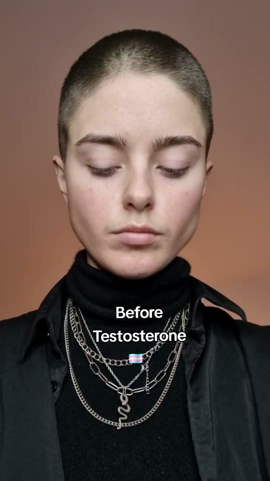 @mx.gialu's testosterone journey claims, fact-checked