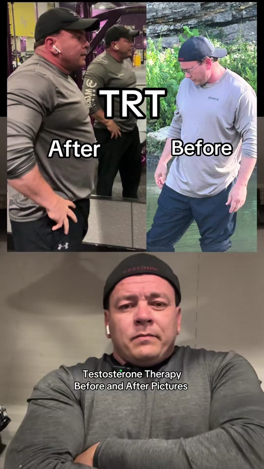 TRT before-and-after claims: what the evidence actually shows