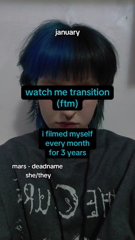 FTM testosterone transition timelines: what TikTok gets right and wrong