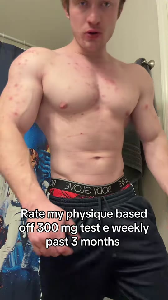 @nattysux's testosterone replacement therapy claims, fact-checked