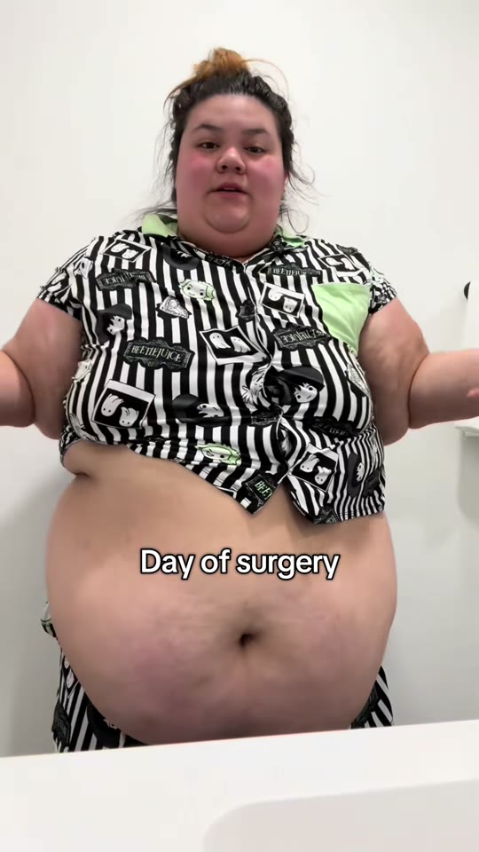 @soliss_pieces's VSG weight loss progress, fact-checked