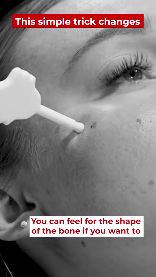 @drtimpearce's cheek filler advice looks solid, actually