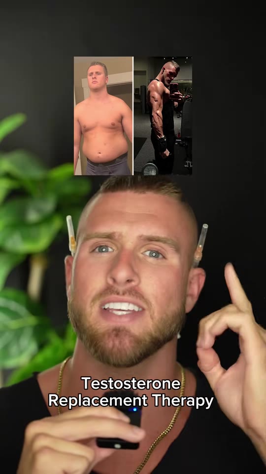 TRT before and after claims: what the evidence actually shows