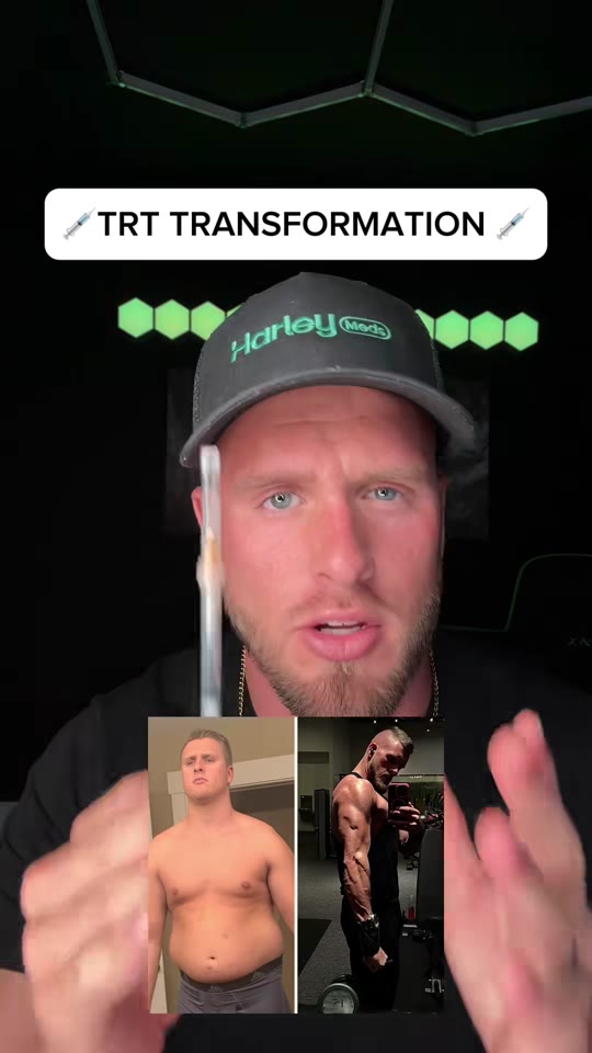 @officialharleymeds's TRT transformation claims, fact-checked