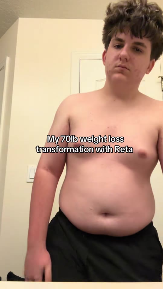 @josh.reyy's TRT transformation claims need context