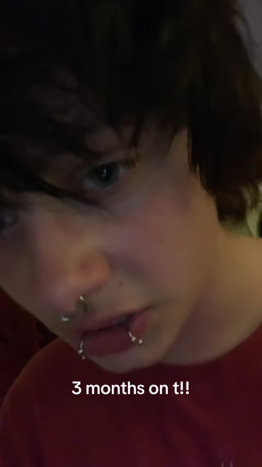 Testosterone voice changes at 3 months: what FTM TikTok gets right and wrong