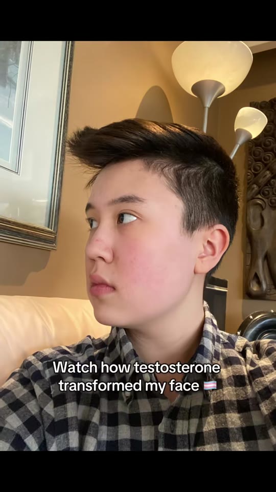 @chasekbrg's testosterone face changes are real, science confirms