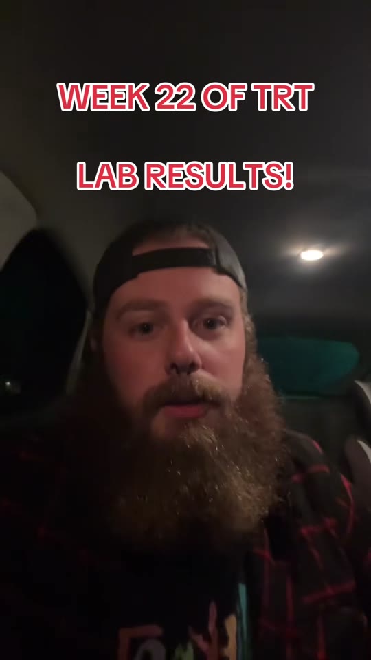 @codyontrt's testosterone blood work update, fact-checked