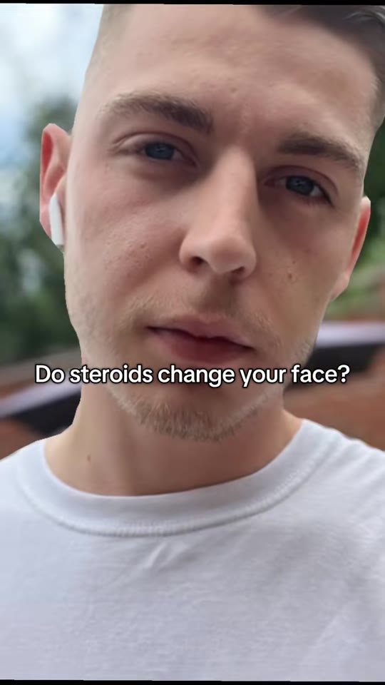 Does 1 year on TRT actually change how your face looks?