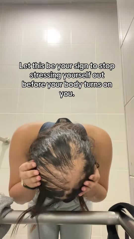 @heskiiii's alopecia areata journey gets fact-checked